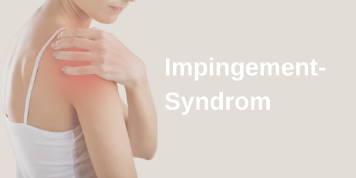 Das Impingement-Syndrom der Schulter